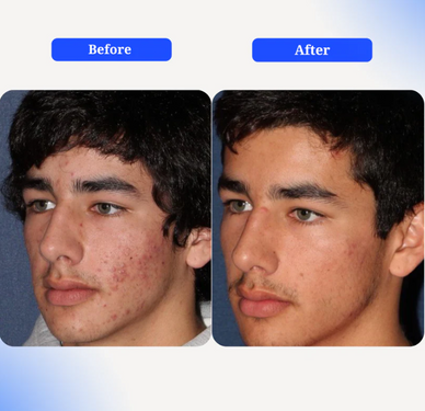 Rediscover Radiance and Confidence Instantly